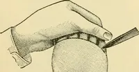 An illustration from Surgical technic; a text-book on operative surgery / by Fr. von Esmarch ... and E. Kowalzig ... translated by Professor Ludwig H. Grau ... and Willam N. Sullivan ... edited by Nicholas Senn ... With fourteen hundred and ninety-seven illustrations and fifteen colored plates. (1901)