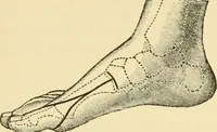 An illustration from Surgical technic; a text-book on operative surgery / by Fr. von Esmarch ... and E. Kowalzig ... translated by Professor Ludwig H. Grau ... and Willam N. Sullivan ... edited by Nicholas Senn ... With fourteen hundred and ninety-seven illustrations and fifteen colored plates. (1901)