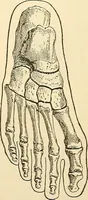 An illustration from Surgical technic; a text-book on operative surgery / by Fr. von Esmarch ... and E. Kowalzig ... translated by Professor Ludwig H. Grau ... and Willam N. Sullivan ... edited by Nicholas Senn ... With fourteen hundred and ninety-seven illustrations and fifteen colored plates. (1901)