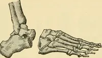 An illustration from Surgical technic; a text-book on operative surgery / by Fr. von Esmarch ... and E. Kowalzig ... translated by Professor Ludwig H. Grau ... and Willam N. Sullivan ... edited by Nicholas Senn ... With fourteen hundred and ninety-seven illustrations and fifteen colored plates. (1901)