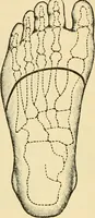 An illustration from Surgical technic; a text-book on operative surgery / by Fr. von Esmarch ... and E. Kowalzig ... translated by Professor Ludwig H. Grau ... and Willam N. Sullivan ... edited by Nicholas Senn ... With fourteen hundred and ninety-seven illustrations and fifteen colored plates. (1901)