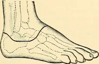 An illustration from Surgical technic; a text-book on operative surgery / by Fr. von Esmarch ... and E. Kowalzig ... translated by Professor Ludwig H. Grau ... and Willam N. Sullivan ... edited by Nicholas Senn ... With fourteen hundred and ninety-seven illustrations and fifteen colored plates. (1901)