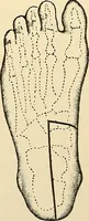 An illustration from Surgical technic; a text-book on operative surgery / by Fr. von Esmarch ... and E. Kowalzig ... translated by Professor Ludwig H. Grau ... and Willam N. Sullivan ... edited by Nicholas Senn ... With fourteen hundred and ninety-seven illustrations and fifteen colored plates. (1901)