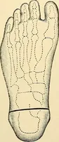 An illustration from Surgical technic; a text-book on operative surgery / by Fr. von Esmarch ... and E. Kowalzig ... translated by Professor Ludwig H. Grau ... and Willam N. Sullivan ... edited by Nicholas Senn ... With fourteen hundred and ninety-seven illustrations and fifteen colored plates. (1901)