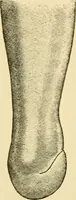 An illustration from Surgical technic; a text-book on operative surgery / by Fr. von Esmarch ... and E. Kowalzig ... translated by Professor Ludwig H. Grau ... and Willam N. Sullivan ... edited by Nicholas Senn ... With fourteen hundred and ninety-seven illustrations and fifteen colored plates. (1901)