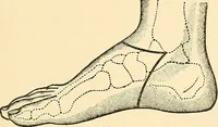 An illustration from Surgical technic; a text-book on operative surgery / by Fr. von Esmarch ... and E. Kowalzig ... translated by Professor Ludwig H. Grau ... and Willam N. Sullivan ... edited by Nicholas Senn ... With fourteen hundred and ninety-seven illustrations and fifteen colored plates. (1901)