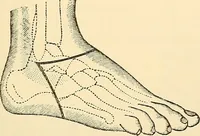 An illustration from Surgical technic; a text-book on operative surgery / by Fr. von Esmarch ... and E. Kowalzig ... translated by Professor Ludwig H. Grau ... and Willam N. Sullivan ... edited by Nicholas Senn ... With fourteen hundred and ninety-seven illustrations and fifteen colored plates. (1901)
