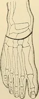 An illustration from Surgical technic; a text-book on operative surgery / by Fr. von Esmarch ... and E. Kowalzig ... translated by Professor Ludwig H. Grau ... and Willam N. Sullivan ... edited by Nicholas Senn ... With fourteen hundred and ninety-seven illustrations and fifteen colored plates. (1901)