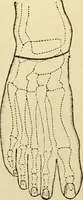 An illustration from Surgical technic; a text-book on operative surgery / by Fr. von Esmarch ... and E. Kowalzig ... translated by Professor Ludwig H. Grau ... and Willam N. Sullivan ... edited by Nicholas Senn ... With fourteen hundred and ninety-seven illustrations and fifteen colored plates. (1901)