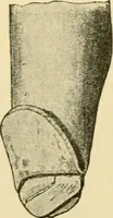 An illustration from Surgical technic; a text-book on operative surgery / by Fr. von Esmarch ... and E. Kowalzig ... translated by Professor Ludwig H. Grau ... and Willam N. Sullivan ... edited by Nicholas Senn ... With fourteen hundred and ninety-seven illustrations and fifteen colored plates. (1901)