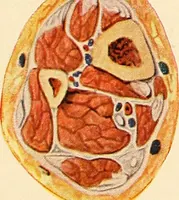 An illustration from Surgical technic; a text-book on operative surgery / by Fr. von Esmarch ... and E. Kowalzig ... translated by Professor Ludwig H. Grau ... and Willam N. Sullivan ... edited by Nicholas Senn ... With fourteen hundred and ninety-seven illustrations and fifteen colored plates. (1901)