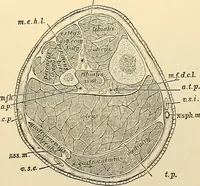 An illustration from Surgical technic; a text-book on operative surgery / by Fr. von Esmarch ... and E. Kowalzig ... translated by Professor Ludwig H. Grau ... and Willam N. Sullivan ... edited by Nicholas Senn ... With fourteen hundred and ninety-seven illustrations and fifteen colored plates. (1901)