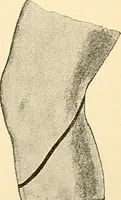 An illustration from Surgical technic; a text-book on operative surgery / by Fr. von Esmarch ... and E. Kowalzig ... translated by Professor Ludwig H. Grau ... and Willam N. Sullivan ... edited by Nicholas Senn ... With fourteen hundred and ninety-seven illustrations and fifteen colored plates. (1901)