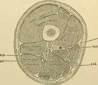 An illustration from Surgical technic; a text-book on operative surgery / by Fr. von Esmarch ... and E. Kowalzig ... translated by Professor Ludwig H. Grau ... and Willam N. Sullivan ... edited by Nicholas Senn ... With fourteen hundred and ninety-seven illustrations and fifteen colored plates. (1901)
