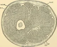 An illustration from Surgical technic; a text-book on operative surgery / by Fr. von Esmarch ... and E. Kowalzig ... translated by Professor Ludwig H. Grau ... and Willam N. Sullivan ... edited by Nicholas Senn ... With fourteen hundred and ninety-seven illustrations and fifteen colored plates. (1901)