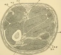 An illustration from Surgical technic; a text-book on operative surgery / by Fr. von Esmarch ... and E. Kowalzig ... translated by Professor Ludwig H. Grau ... and Willam N. Sullivan ... edited by Nicholas Senn ... With fourteen hundred and ninety-seven illustrations and fifteen colored plates. (1901)