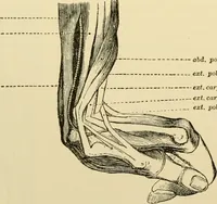 An illustration from Surgical technic; a text-book on operative surgery / by Fr. von Esmarch ... and E. Kowalzig ... translated by Professor Ludwig H. Grau ... and Willam N. Sullivan ... edited by Nicholas Senn ... With fourteen hundred and ninety-seven illustrations and fifteen colored plates. (1901)
