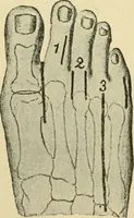 An illustration from Surgical technic; a text-book on operative surgery / by Fr. von Esmarch ... and E. Kowalzig ... translated by Professor Ludwig H. Grau ... and Willam N. Sullivan ... edited by Nicholas Senn ... With fourteen hundred and ninety-seven illustrations and fifteen colored plates. (1901)