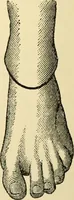An illustration from Surgical technic; a text-book on operative surgery / by Fr. von Esmarch ... and E. Kowalzig ... translated by Professor Ludwig H. Grau ... and Willam N. Sullivan ... edited by Nicholas Senn ... With fourteen hundred and ninety-seven illustrations and fifteen colored plates. (1901)