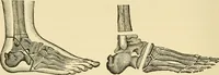An illustration from Surgical technic; a text-book on operative surgery / by Fr. von Esmarch ... and E. Kowalzig ... translated by Professor Ludwig H. Grau ... and Willam N. Sullivan ... edited by Nicholas Senn ... With fourteen hundred and ninety-seven illustrations and fifteen colored plates. (1901)