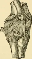 An illustration from Surgical technic; a text-book on operative surgery / by Fr. von Esmarch ... and E. Kowalzig ... translated by Professor Ludwig H. Grau ... and Willam N. Sullivan ... edited by Nicholas Senn ... With fourteen hundred and ninety-seven illustrations and fifteen colored plates. (1901)