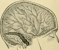 An illustration from Surgical technic; a text-book on operative surgery / by Fr. von Esmarch ... and E. Kowalzig ... translated by Professor Ludwig H. Grau ... and Willam N. Sullivan ... edited by Nicholas Senn ... With fourteen hundred and ninety-seven illustrations and fifteen colored plates. (1901)