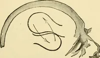 An illustration from Surgical technic; a text-book on operative surgery / by Fr. von Esmarch ... and E. Kowalzig ... translated by Professor Ludwig H. Grau ... and Willam N. Sullivan ... edited by Nicholas Senn ... With fourteen hundred and ninety-seven illustrations and fifteen colored plates. (1901)