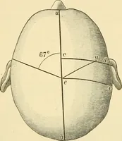 An illustration from Surgical technic; a text-book on operative surgery / by Fr. von Esmarch ... and E. Kowalzig ... translated by Professor Ludwig H. Grau ... and Willam N. Sullivan ... edited by Nicholas Senn ... With fourteen hundred and ninety-seven illustrations and fifteen colored plates. (1901)