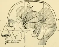 An illustration from Surgical technic; a text-book on operative surgery / by Fr. von Esmarch ... and E. Kowalzig ... translated by Professor Ludwig H. Grau ... and Willam N. Sullivan ... edited by Nicholas Senn ... With fourteen hundred and ninety-seven illustrations and fifteen colored plates. (1901)