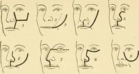 An illustration from Surgical technic; a text-book on operative surgery / by Fr. von Esmarch ... and E. Kowalzig ... translated by Professor Ludwig H. Grau ... and Willam N. Sullivan ... edited by Nicholas Senn ... With fourteen hundred and ninety-seven illustrations and fifteen colored plates. (1901)