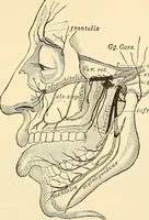 An illustration from Surgical technic; a text-book on operative surgery / by Fr. von Esmarch ... and E. Kowalzig ... translated by Professor Ludwig H. Grau ... and Willam N. Sullivan ... edited by Nicholas Senn ... With fourteen hundred and ninety-seven illustrations and fifteen colored plates. (1901)