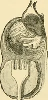 An illustration from Surgical technic; a text-book on operative surgery / by Fr. von Esmarch ... and E. Kowalzig ... translated by Professor Ludwig H. Grau ... and Willam N. Sullivan ... edited by Nicholas Senn ... With fourteen hundred and ninety-seven illustrations and fifteen colored plates. (1901)