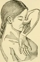An illustration from Surgical technic; a text-book on operative surgery / by Fr. von Esmarch ... and E. Kowalzig ... translated by Professor Ludwig H. Grau ... and Willam N. Sullivan ... edited by Nicholas Senn ... With fourteen hundred and ninety-seven illustrations and fifteen colored plates. (1901)