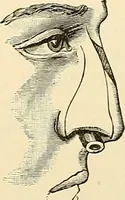 An illustration from Surgical technic; a text-book on operative surgery / by Fr. von Esmarch ... and E. Kowalzig ... translated by Professor Ludwig H. Grau ... and Willam N. Sullivan ... edited by Nicholas Senn ... With fourteen hundred and ninety-seven illustrations and fifteen colored plates. (1901)