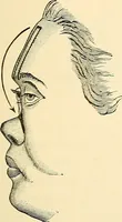 An illustration from Surgical technic; a text-book on operative surgery / by Fr. von Esmarch ... and E. Kowalzig ... translated by Professor Ludwig H. Grau ... and Willam N. Sullivan ... edited by Nicholas Senn ... With fourteen hundred and ninety-seven illustrations and fifteen colored plates. (1901)
