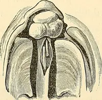 An illustration from Surgical technic; a text-book on operative surgery / by Fr. von Esmarch ... and E. Kowalzig ... translated by Professor Ludwig H. Grau ... and Willam N. Sullivan ... edited by Nicholas Senn ... With fourteen hundred and ninety-seven illustrations and fifteen colored plates. (1901)