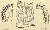An illustration from Surgical technic; a text-book on operative surgery / by Fr. von Esmarch ... and E. Kowalzig ... translated by Professor Ludwig H. Grau ... and Willam N. Sullivan ... edited by Nicholas Senn ... With fourteen hundred and ninety-seven illustrations and fifteen colored plates. (1901)