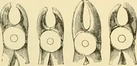 An illustration from Surgical technic; a text-book on operative surgery / by Fr. von Esmarch ... and E. Kowalzig ... translated by Professor Ludwig H. Grau ... and Willam N. Sullivan ... edited by Nicholas Senn ... With fourteen hundred and ninety-seven illustrations and fifteen colored plates. (1901)