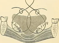 An illustration from Surgical technic; a text-book on operative surgery / by Fr. von Esmarch ... and E. Kowalzig ... translated by Professor Ludwig H. Grau ... and Willam N. Sullivan ... edited by Nicholas Senn ... With fourteen hundred and ninety-seven illustrations and fifteen colored plates. (1901)