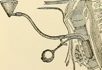 An illustration from Surgical technic; a text-book on operative surgery / by Fr. von Esmarch ... and E. Kowalzig ... translated by Professor Ludwig H. Grau ... and Willam N. Sullivan ... edited by Nicholas Senn ... With fourteen hundred and ninety-seven illustrations and fifteen colored plates. (1901)