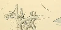 An illustration from Surgical technic; a text-book on operative surgery / by Fr. von Esmarch ... and E. Kowalzig ... translated by Professor Ludwig H. Grau ... and Willam N. Sullivan ... edited by Nicholas Senn ... With fourteen hundred and ninety-seven illustrations and fifteen colored plates. (1901)
