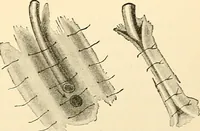 An illustration from Surgical technic; a text-book on operative surgery / by Fr. von Esmarch ... and E. Kowalzig ... translated by Professor Ludwig H. Grau ... and Willam N. Sullivan ... edited by Nicholas Senn ... With fourteen hundred and ninety-seven illustrations and fifteen colored plates. (1901)