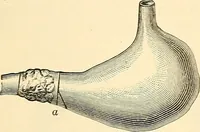 An illustration from Surgical technic; a text-book on operative surgery / by Fr. von Esmarch ... and E. Kowalzig ... translated by Professor Ludwig H. Grau ... and Willam N. Sullivan ... edited by Nicholas Senn ... With fourteen hundred and ninety-seven illustrations and fifteen colored plates. (1901)