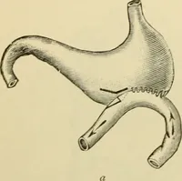 An illustration from Surgical technic; a text-book on operative surgery / by Fr. von Esmarch ... and E. Kowalzig ... translated by Professor Ludwig H. Grau ... and Willam N. Sullivan ... edited by Nicholas Senn ... With fourteen hundred and ninety-seven illustrations and fifteen colored plates. (1901)