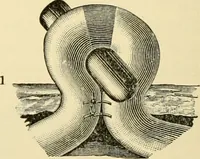 An illustration from Surgical technic; a text-book on operative surgery / by Fr. von Esmarch ... and E. Kowalzig ... translated by Professor Ludwig H. Grau ... and Willam N. Sullivan ... edited by Nicholas Senn ... With fourteen hundred and ninety-seven illustrations and fifteen colored plates. (1901)