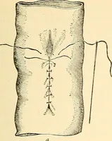 An illustration from Surgical technic; a text-book on operative surgery / by Fr. von Esmarch ... and E. Kowalzig ... translated by Professor Ludwig H. Grau ... and Willam N. Sullivan ... edited by Nicholas Senn ... With fourteen hundred and ninety-seven illustrations and fifteen colored plates. (1901)