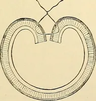 An illustration from Surgical technic; a text-book on operative surgery / by Fr. von Esmarch ... and E. Kowalzig ... translated by Professor Ludwig H. Grau ... and Willam N. Sullivan ... edited by Nicholas Senn ... With fourteen hundred and ninety-seven illustrations and fifteen colored plates. (1901)
