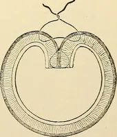 An illustration from Surgical technic; a text-book on operative surgery / by Fr. von Esmarch ... and E. Kowalzig ... translated by Professor Ludwig H. Grau ... and Willam N. Sullivan ... edited by Nicholas Senn ... With fourteen hundred and ninety-seven illustrations and fifteen colored plates. (1901)