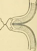 An illustration from Surgical technic; a text-book on operative surgery / by Fr. von Esmarch ... and E. Kowalzig ... translated by Professor Ludwig H. Grau ... and Willam N. Sullivan ... edited by Nicholas Senn ... With fourteen hundred and ninety-seven illustrations and fifteen colored plates. (1901)