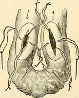 An illustration from Surgical technic; a text-book on operative surgery / by Fr. von Esmarch ... and E. Kowalzig ... translated by Professor Ludwig H. Grau ... and Willam N. Sullivan ... edited by Nicholas Senn ... With fourteen hundred and ninety-seven illustrations and fifteen colored plates. (1901)
